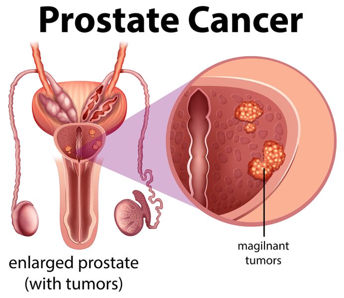 Treatment Image