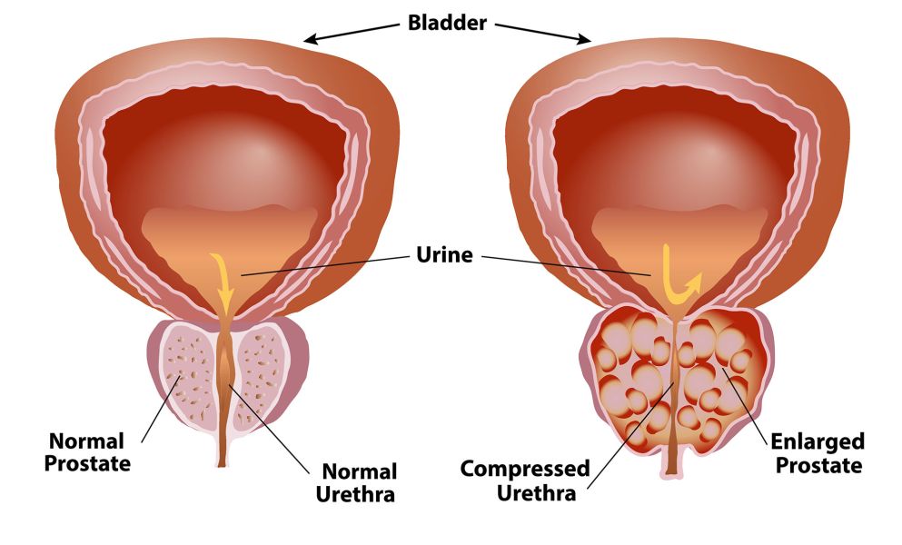 Treatment Image