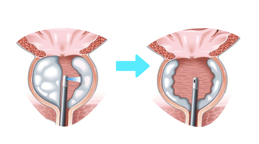 Treatment Image