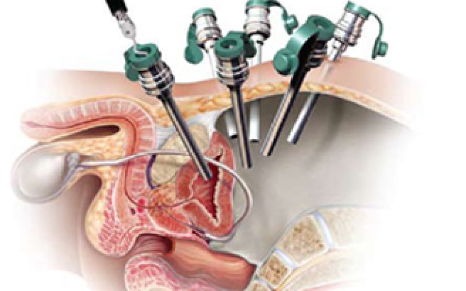 Treatment Image